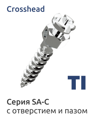 Титановые межкорневые минивинты Smart Anchor